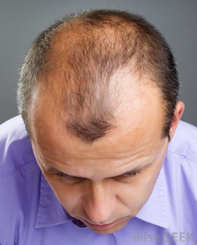 methods to regrow hair naturally